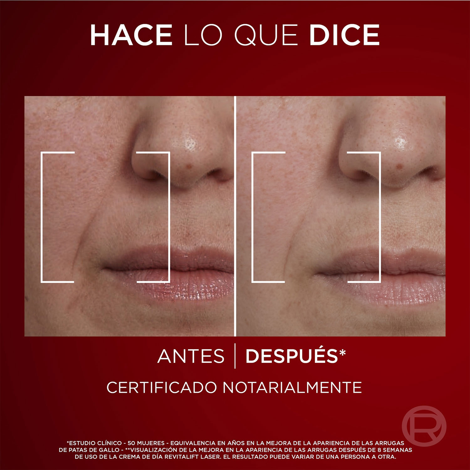 Crema Facial Loreal Revitalift Laser Día X 50 Ml - Imagen 7
